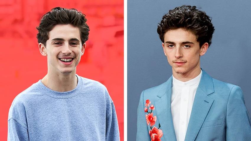 Why Timothée Chalamet’s Look Is So Popular
